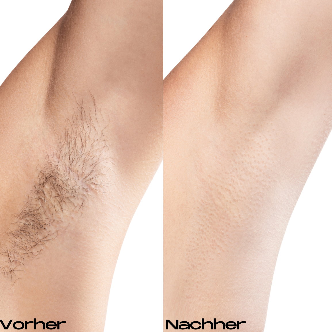 Noora Pro™ Mini Rasierer