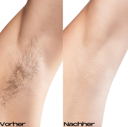 Noora Pro™ Mini Rasierer