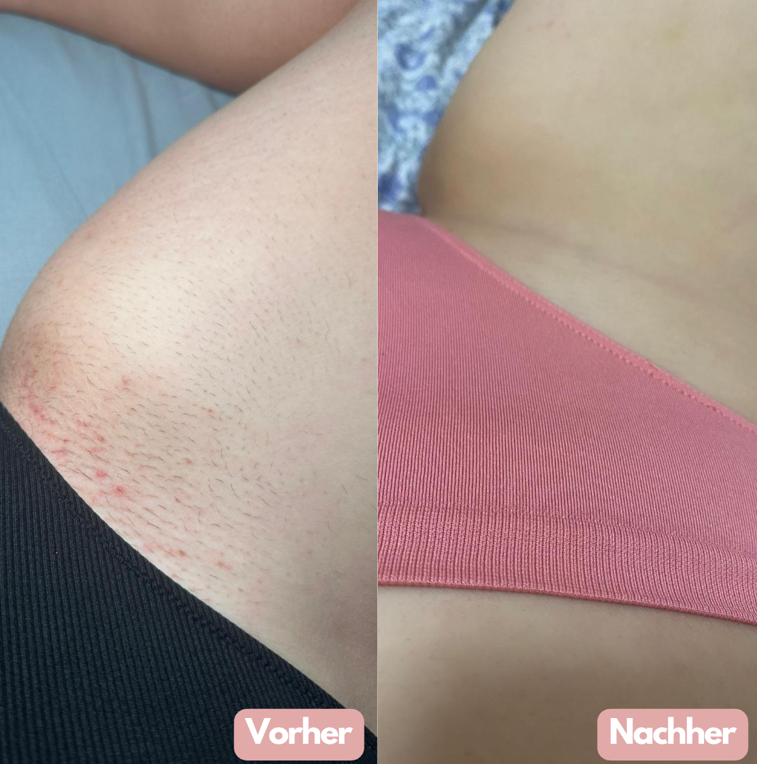 Noora Pro™ Rasierer